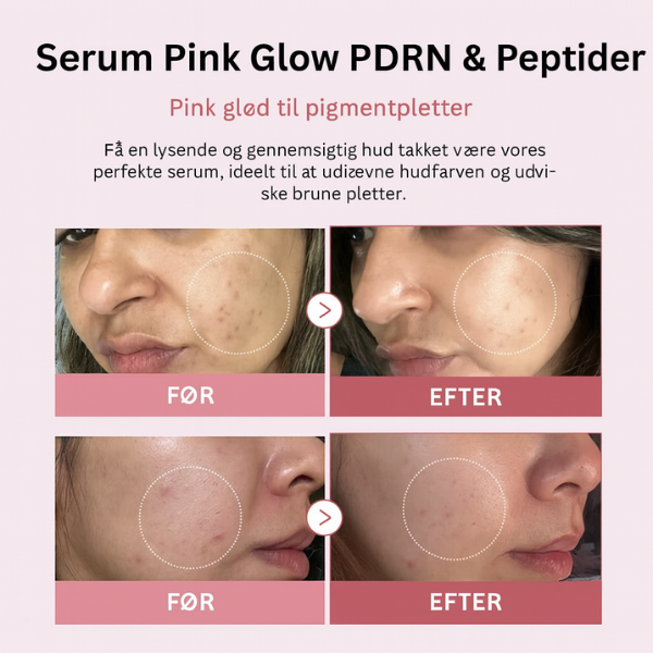 PDRN PINK GLOW SERUM